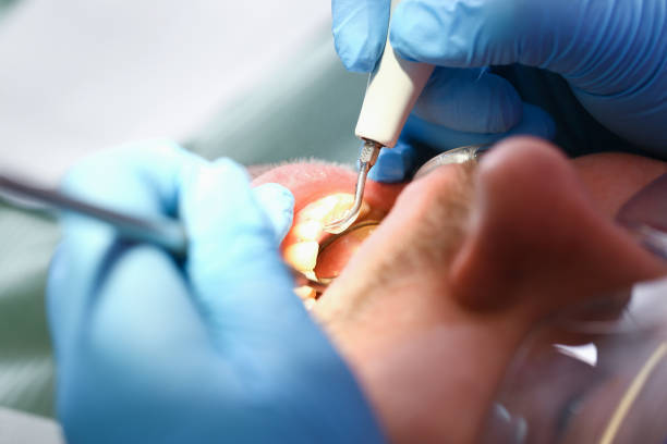 Best Weekend Emergency Dentist in Fate, TX