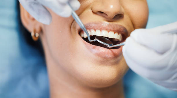 Best Weekend Emergency Dentist in Fate, TX